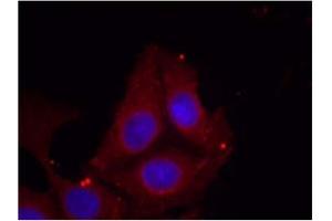 Image no. 1 for anti-Growth Associated Protein 43 (GAP43) (pSer41) antibody (ABIN401573) (GAP43 anticorps  (pSer41))