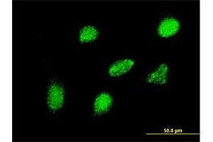 Immunofluorescence of monoclonal antibody to HEYL on HeLa cell. (HEYL anticorps  (AA 221-327))