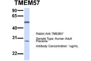 Host:  Rabbit  Target Name:  TMEM57  Sample Type:  Human Adult Placenta  Antibody Dilution:  1. (TMEM57 anticorps  (N-Term))