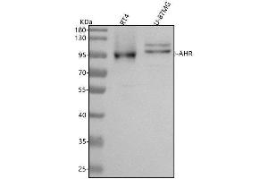 Western blot analysis of AhR using anti-AhR antibody (ABIN7603929).