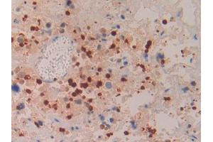 Used in DAB staining on fromalin fixed paraffin- embedded liver tissue (Azurocidin anticorps  (AA 23-247))