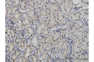 Immunoperoxidase of monoclonal antibody to PAX7 on formalin-fixed paraffin-embedded human stomach.
