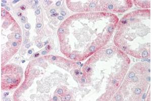 Image no. 2 for anti-Solute Carrier Family 22 Member 6 (SLC22A6) (C-Term) antibody (ABIN6749721)