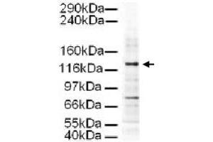 Western blot using AP3D1 polyclonal antibody  shows detection of a 130 KDa band corresponding to Human AP3D1 in a HeLa whole cell lysate. (AP3D1 anticorps  (AA 686-698))