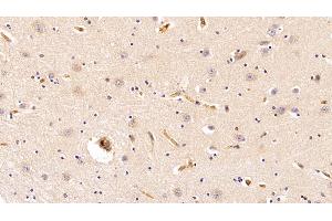 Detection of Hpt in Porcine Cerebrum Tissue using Polyclonal Antibody to Haptoglobin (Hpt)