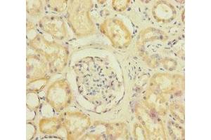 Immunohistochemistry of paraffin-embedded human kidney tissue using ABIN7170910 at dilution of 1:100 (SUCLA2 anticorps  (AA 1-180))