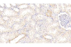 Detection of AhR in Human Kidney Tissue using Polyclonal Antibody to Aryl Hydrocarbon Receptor (AhR)