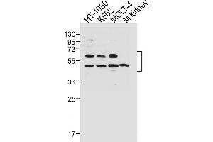 All lanes : Anti-WT1 Antibody (Center ) at 1:1000 dilution Lane 1: HT-1080 whole cell lysate Lane 2: K562 whole cell lysate Lane 3: MOLT-4 whole cell lysate Lane 4: Mouse kidney lysate Lysates/proteins at 20 μg per lane. (WT1 anticorps  (AA 346-375))