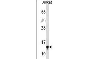 RPS23 Antibody (N-term) (ABIN1538877 and ABIN2850072) western blot analysis in Jurkat cell line lysates (35 μg/lane). (RPS23 anticorps  (N-Term))