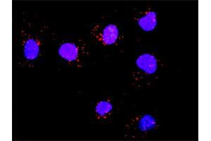 Proximity Ligation Analysis of protein-protein interactions between GAB1 and SOS1. (SOS1 anticorps  (AA 313-420))