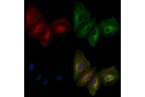ABIN6261372 and ABIN6279351 staining  cells by IF/ICC. (Desmoglein 3 anticorps  (C-Term))