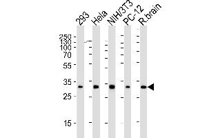 Western blot analysis of lysates from 293, Hela, mouse NIH/3T3, rat PC-12 cell line and rat brain tissue lysate(from left to right), using RPS6 Antibody (N-term) (ABIN6242615 and ABIN6577071).