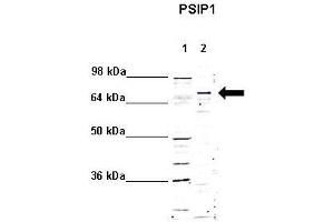 WB Suggested Anti-PSIP1 Antibody    Positive Control:  Lane 1: 5ug mouse brain cytoplasm Lane 2: 5ug mouse brain nucleus   Primary Antibody Dilution :   1:1000  Secondary Antibody :  Anti rabbit - IR-dye  Secondry Antibody Dilution :   1:10,000   Submitted by:  Anonymous (PSIP1 anticorps  (Middle Region))