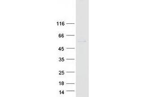 Validation with Western Blot