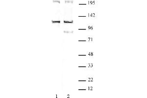 TRIM37 antibody (pAb) tested by Western blot. (TRIM37 anticorps  (C-Term))