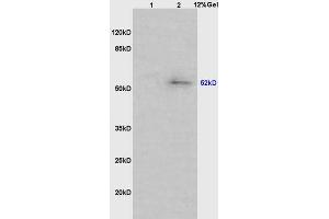 Lane 1: mouse intestine lysates Lane 2: mouse lung lysates probed with Anti phospho-MAPKAPK5(Ser93) Polyclonal Antibody, Unconjugated (ABIN710561) at 1:200 in 4 °C.