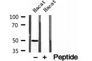 Western blot analysis of extracts of Hacat cells, using AP1M1 antibody. (AP1M1 anticorps  (Internal Region))