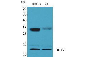 Western Blotting (WB) image for anti-Tissue Factor Pathway Inhibitor 2 (TFPI2) (C-Term) antibody (ABIN3178190) (TFPI2 anticorps  (C-Term))