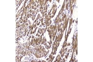 IHC testing of FFPE rat heart tissue with FABP3 antibody at 2ug/ml. (FABP3 anticorps  (AA 2-133))