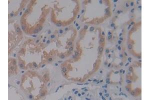 DAB staining on IHC-P; Samples: Human Kidney Tissue (CRY1 anticorps  (AA 3-132))