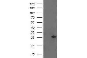 Western Blotting (WB) image for anti-Adenylate Kinase 4 (AK4) antibody (ABIN1496526) (AK4 anticorps)