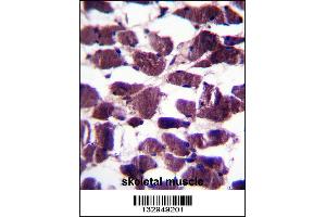 anti-Leucine-Rich Repeats and Immunoglobulin-Like Domains 2 (LRIG2) (AA 817-845), (C-Term) antibody