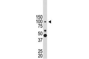 Image no. 1 for anti-Prospero Homeobox 1 (PROX1) (N-Term) antibody (ABIN357416)
