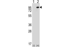 Western blot analysis of WHSC1L1 (arrow) using rabbit polyclonal WHSC1L1 Antibody (N-term) . (WHSC1L1 anticorps  (N-Term))