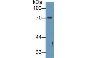 WB of Protein Standard: different control antibodies against Highly purified E. (Angiopoietin 2 Kit CLIA)