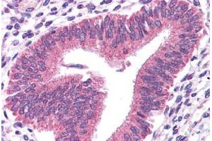 Human Uterus: Formalin-Fixed, Paraffin-Embedded (FFPE)