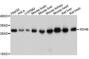 Western blot analysis of extracts of various cell lines, using SDHB antibody. (SDHB anticorps  (AA 29-280))