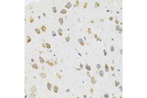 Immunohistochemistry of paraffin-embedded mouse brain using TGM2 antibody (ABIN5970369) (40x lens).