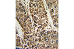 anti-Microsomal Triglyceride Transfer Protein (MTTP) (AA 816-842), (C-Term) antibody