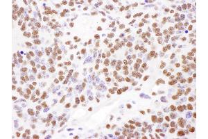 Immunohistochemistry (IHC) image for anti-Poly A Binding Protein Nuclear 1 (PABPN1) (AA 1-50) antibody (ABIN7454922) (PABPN1 anticorps  (AA 1-50))