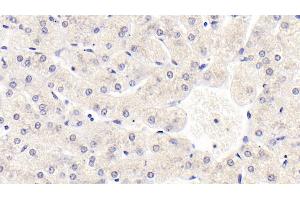Detection of SIRT3 in Human Liver Tissue using Monoclonal Antibody to Sirtuin 3 (SIRT3) (SIRT3 anticorps  (AA 126-399))