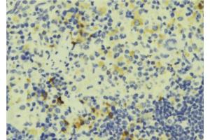 ABIN6274227 at 1/100 staining Human lymph tissue by IHC-P. (Coronin 1a anticorps  (Internal Region))