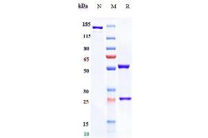 Anti-NGF / bNGF Reference Antibody (AS2886401-00) on SDS-PAGE under reducing (R) condition.