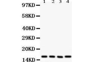 Western Blotting (WB) image for anti-Caveolin 2 (CAV2) (AA 1-162) antibody (ABIN3043749) (Caveolin 2 anticorps  (AA 1-162))