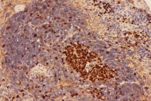 Anti-Beclin 1 Picoband antibody, IHC(P): Mouse Spleen Tissue