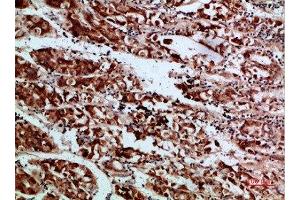 Immunohistochemical analysis of paraffin-embedded human-stomach, antibody was diluted at 1:200