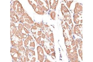 Immunohistochemistry of paraffin-embedded Human stomach using KIF14 Polyclonal Antibody at dilution of 1:100 (40x lens).