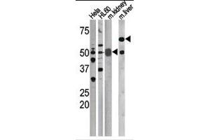 Image no. 1 for anti-Cell Division Cycle 25 Homolog A (S. Pombe) (CDC25A) (pSer76) antibody (ABIN358097) (CDC25A anticorps  (pSer76))