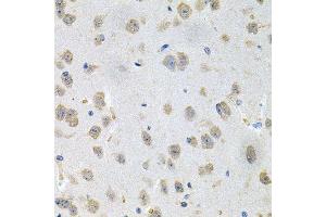 Immunohistochemistry of paraffin-embedded mouse brain using GNE antibody.