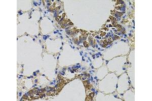 Immunohistochemistry of paraffin-embedded Mouse lung using CKAP4 Polyclonal Antibody (CKAP4 anticorps)