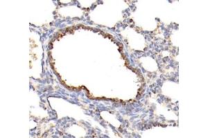 Immunohistochemistry of paraffin embedded rat testis using MLF1 (ABIN7074712) at dilution of 1: 1500 (400x lens)