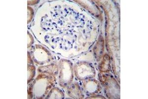 Immunohistochemistry analysis in formalin fixed and paraffin embedded human kidney tissue reacted with STARD5 Antibody (N-term) followed which was peroxidase conjugated to the secondary antibody and followed by AB staining.