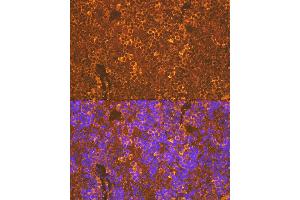 Immunofluorescence analysis of rat spleen using CXCR5 Rabbit mAb (ABIN7266321) at dilution of 1:100 (40x lens).