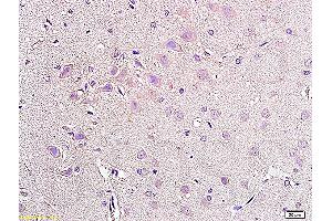 Formalin-fixed and paraffin embedded rat brain tissue labeled with Anti-NPY2R Polyclonal Antibody, Unconjugated (ABIN730063) at 1:200, followed by conjugation to the secondary antibody and DAB staining (NPY2R anticorps  (AA 301-381))