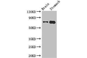 Western Blot Positive WB detected in: Mouse brain tissue, Mouse stomach tissue All lanes: EXD2 antibody at 2. (EXD2 anticorps  (AA 137-245))