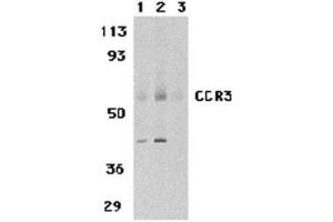 Western blot analysis of CCR3 in human spleen tissue lysates with AP30216PU-N CCR3 antibody at 1 (lane 1) and 2 μg/ml (lane 2), and 2 μg/ml in the presence of blocking peptide (lane 3). (CCR3 anticorps  (N-Term))